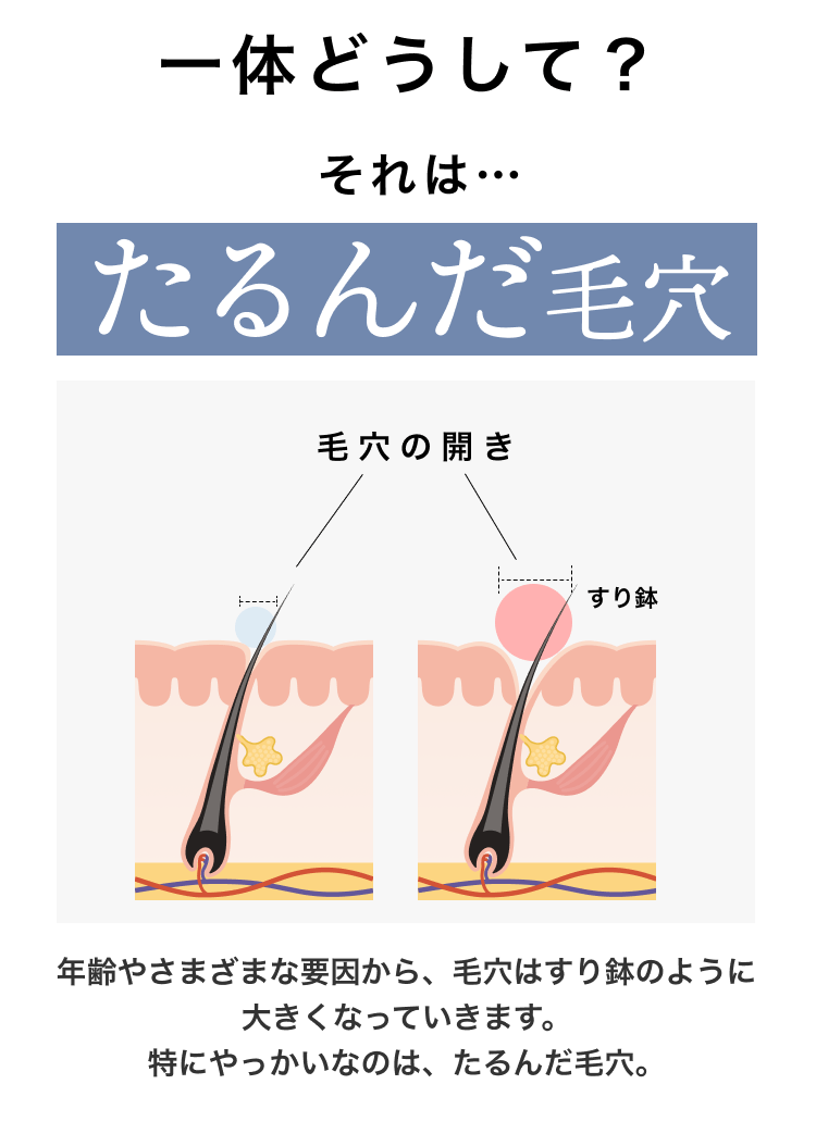 レディアン（毛穴ケアライン）,効果なし,評判,口コミ